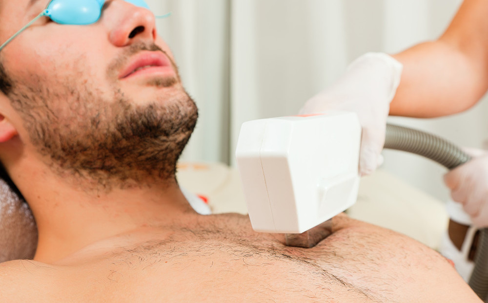 IPL ontharen van de borst bij man – permanente haarverwijdering lichaam